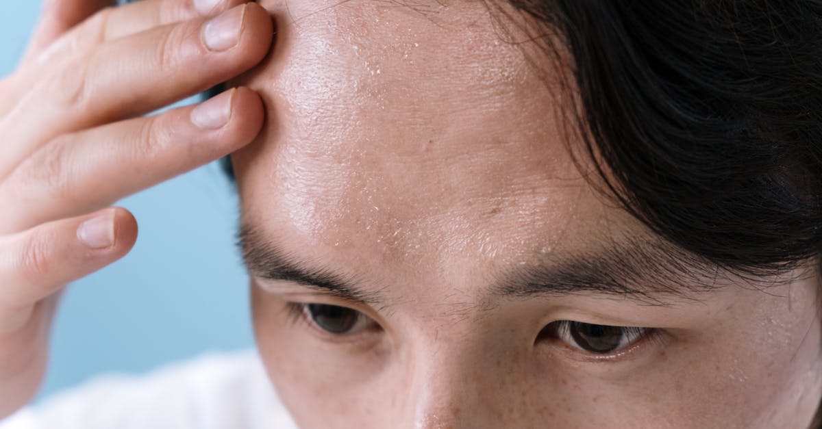 Quels sont les problèmes oculaires courants et leurs symptômes ?