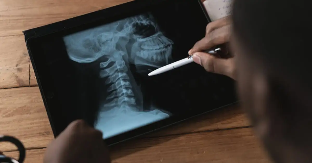 Comment distinguer une entorse d'une fracture facilement ?